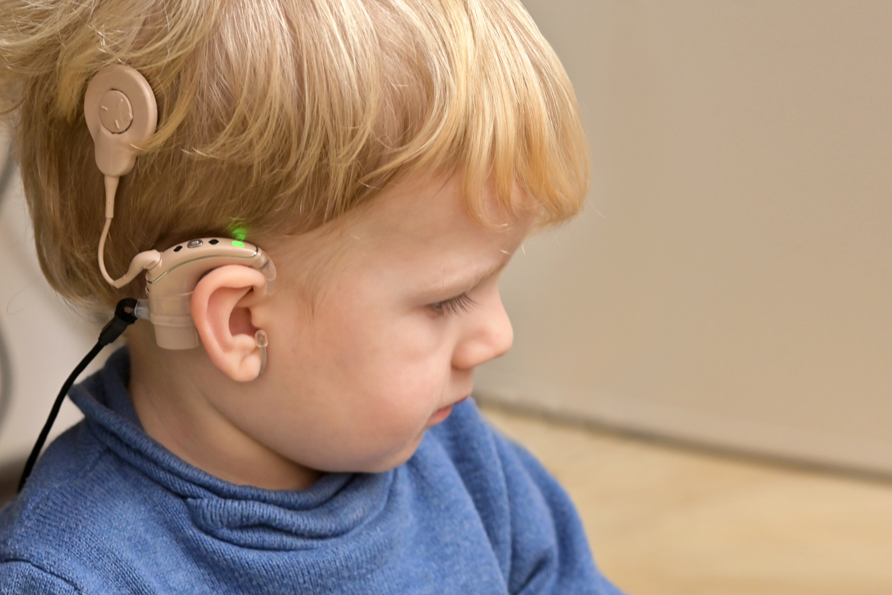 A Boy With A Hearing Aids And Cochlear Implants